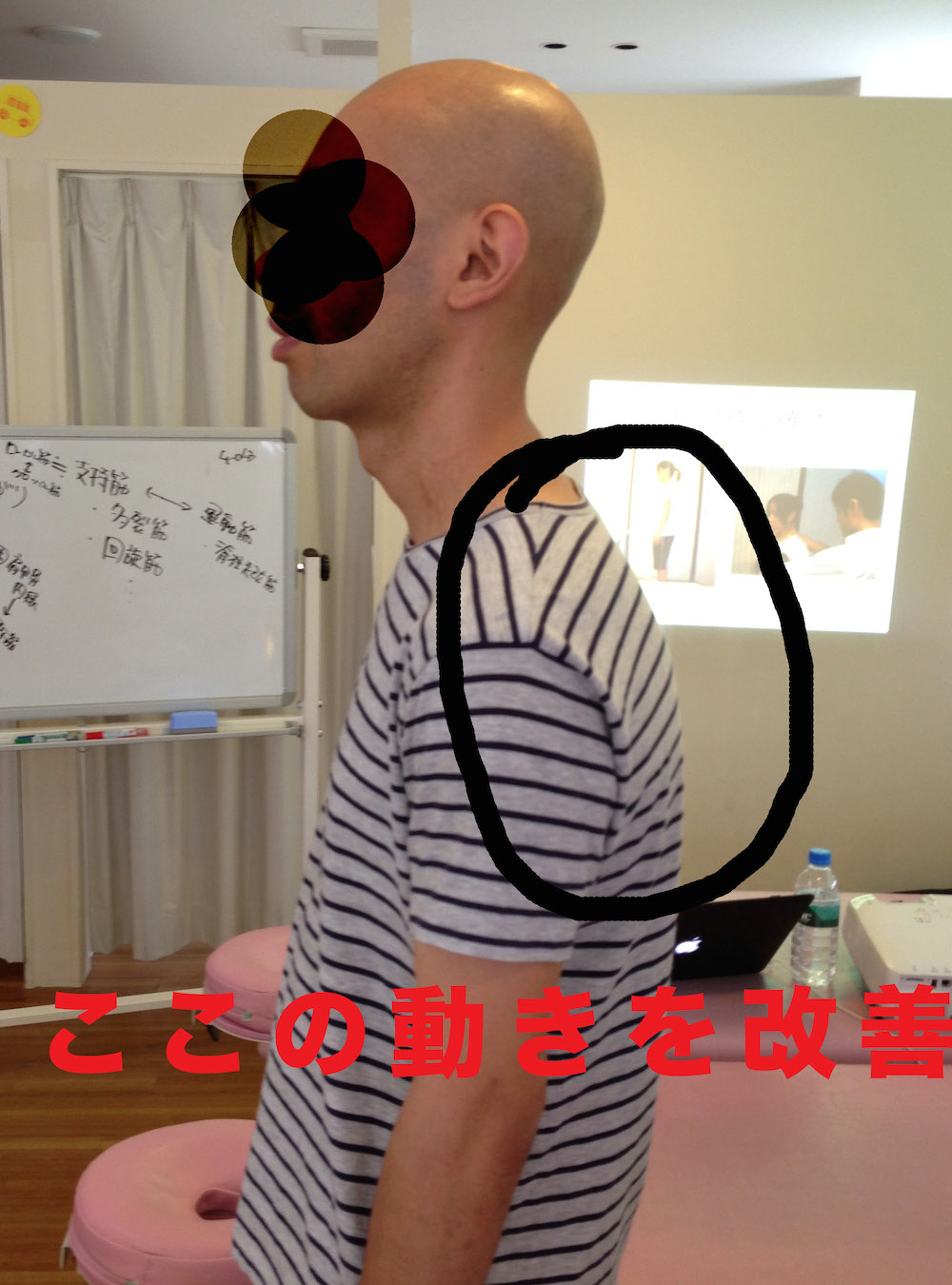 顎が上がる人は 胸椎の動きを改善せよ 猫背矯正カレッジ