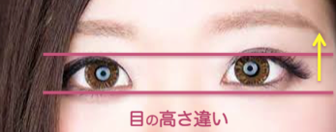 目の高さ違いがあると眉毛の高さも違うんです 眉毛が左右均等にかけない理由はこれです シンメトリー美人革命