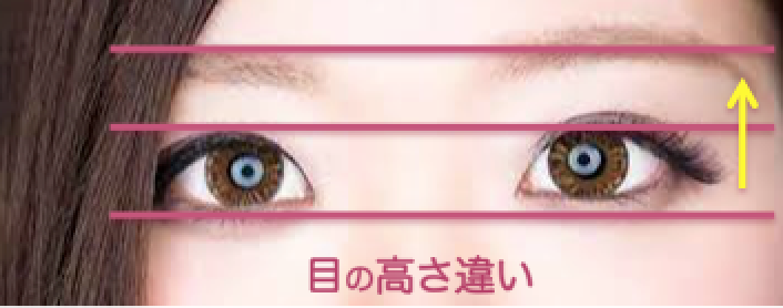 目の高さ違いがあると眉毛の高さも違うんです 眉毛が左右均等にかけない理由はこれです シンメトリー美人革命