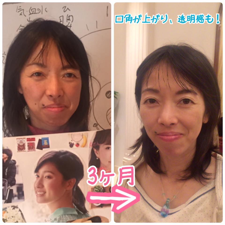 A.Mさんbefore after　３ヶ月