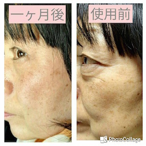 57歳