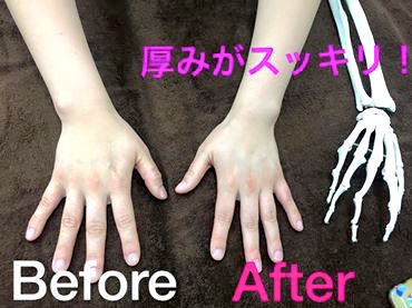 beforeafter_hand.jpg