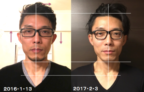 RyuさんBeforeAfter.png