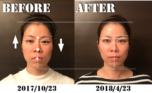 有安愛さんBeforeafter.png