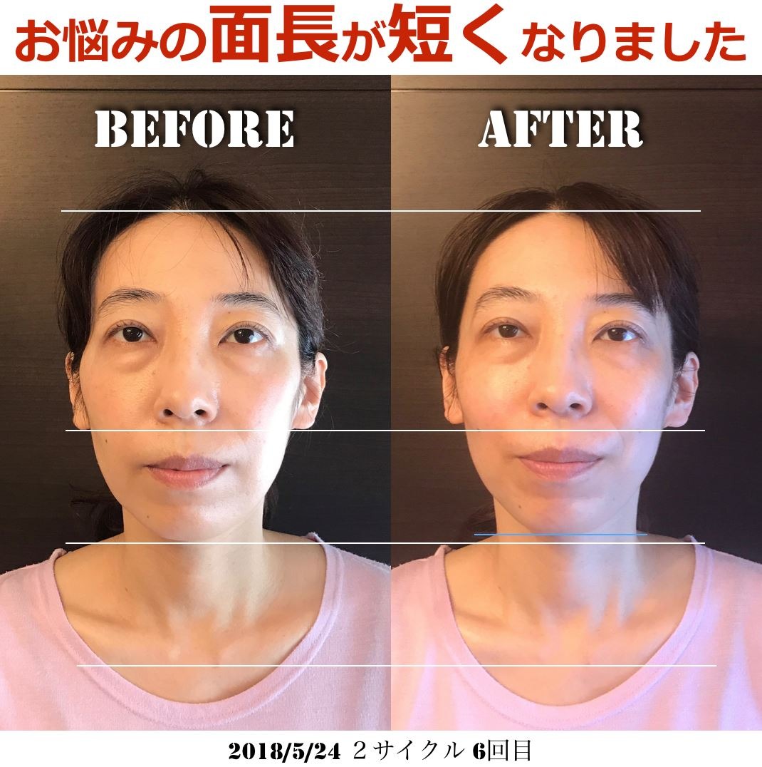 BeforeAfter面長.jpg