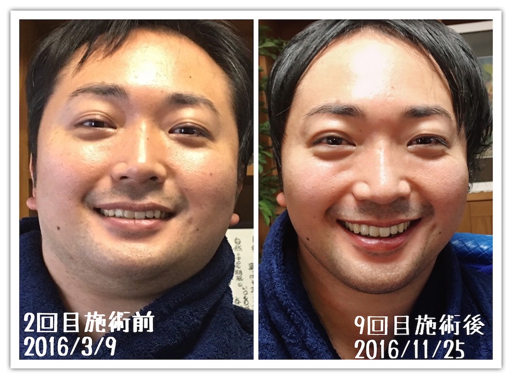 山口さんBeforeafter.jpg