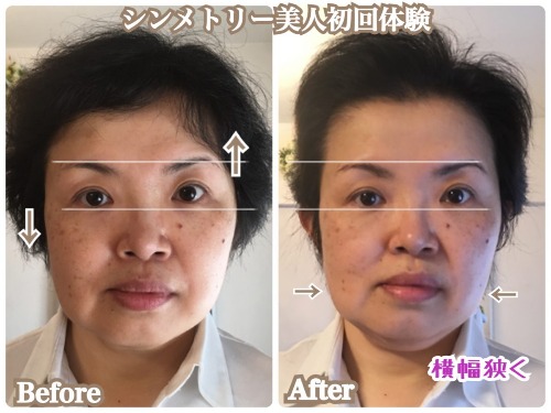 塚田かずよさんbeforeafter.jpg