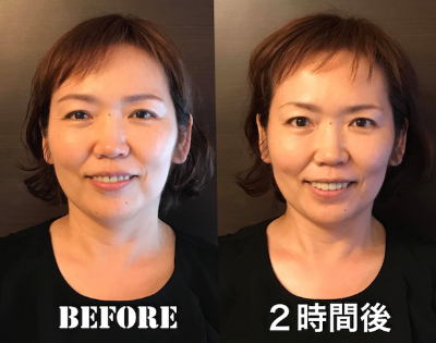 内藤まゆみさんBeforeAfter2.png