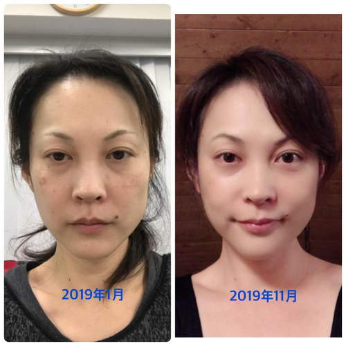 児山郁恵Beforeafter.jpg