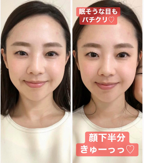 美鈴さんBeforeAfter.jpg