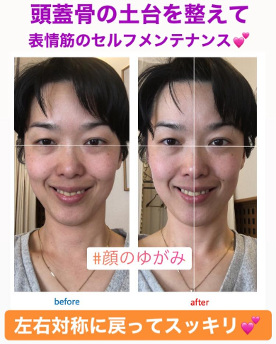 BeforeAfter西村さん.jpg