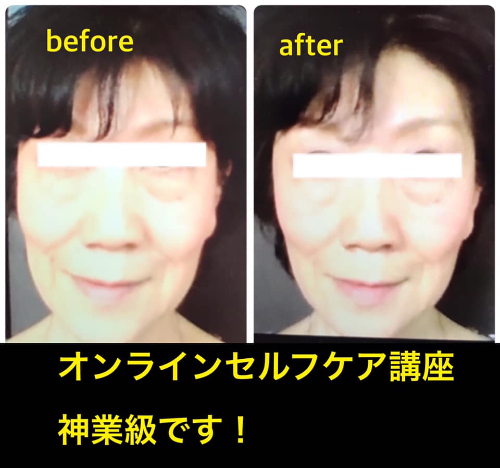 BeforeAfterオンライン渡辺さんのお客様.jpg