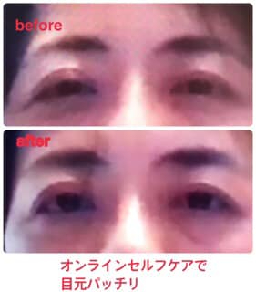 Beforeafter目オンライン 渡辺さんのお客様.jpg