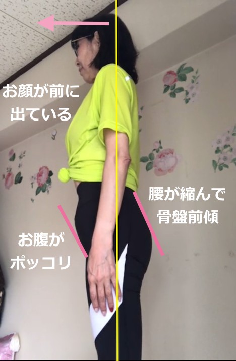 骨盤前傾顔が前.png