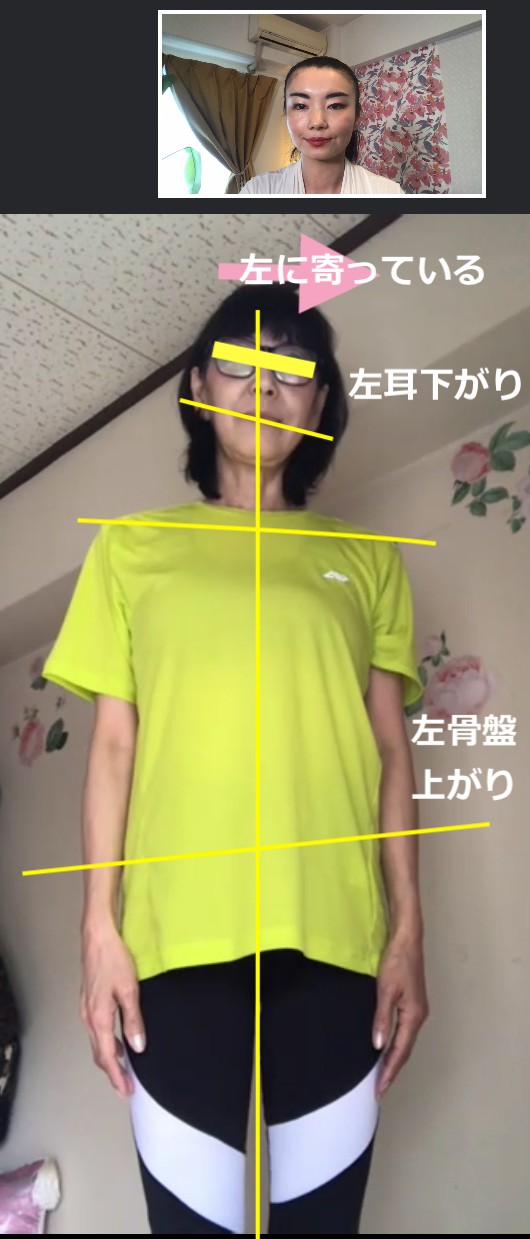 Before左寄.png