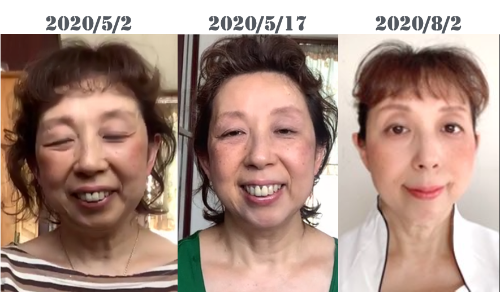 田辺裕英さんBeforeAfter.png