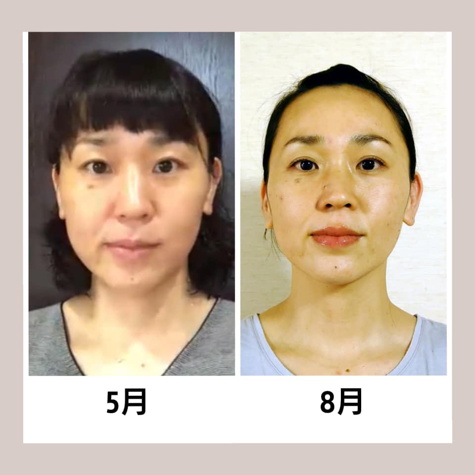 井上智恵子さんBeforeAfter.jpg