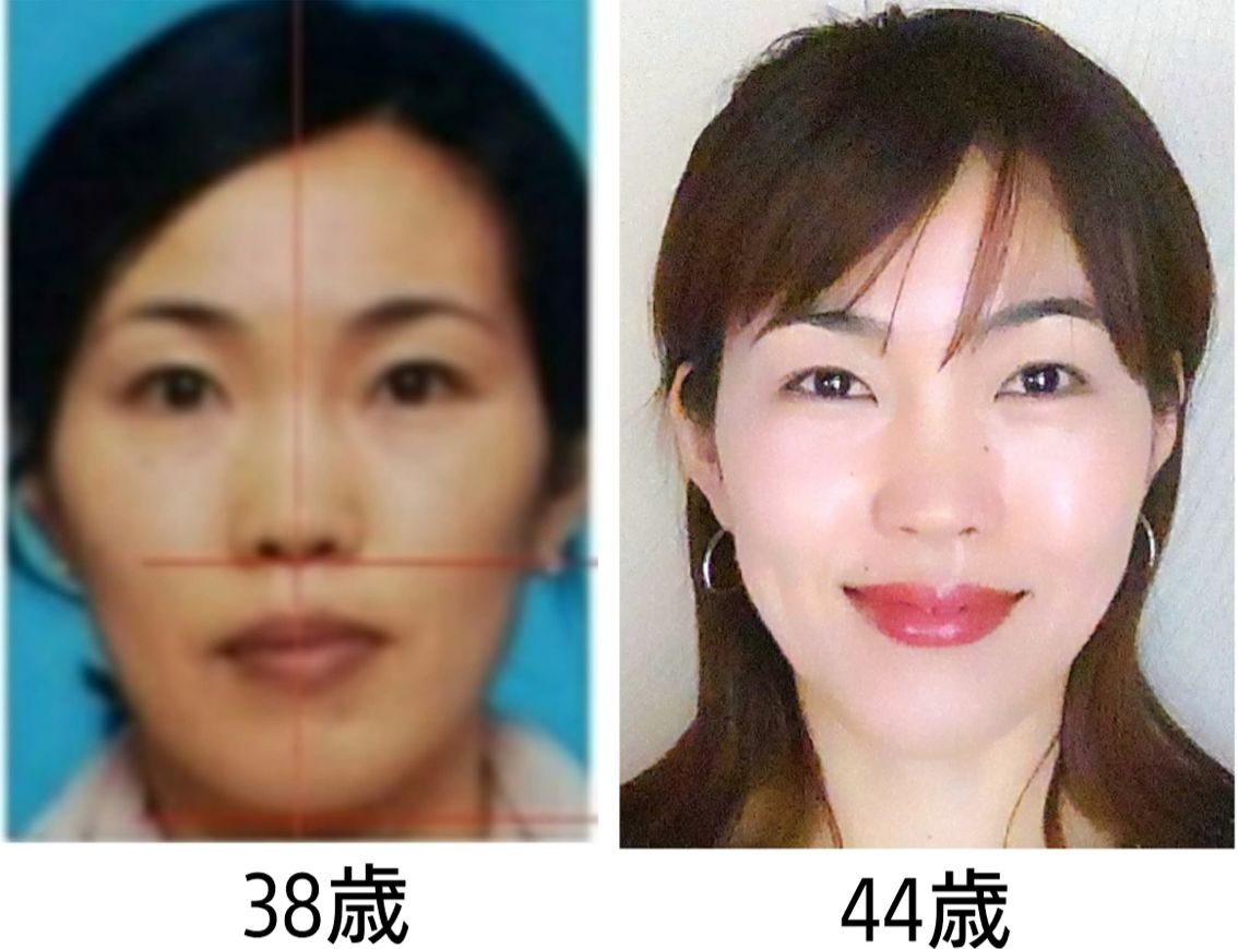 山口友香子さんBeforeAfter6年.png