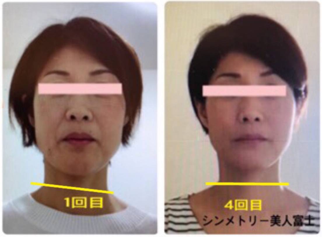 渡辺数代さんのお客様のbeforeafter.png