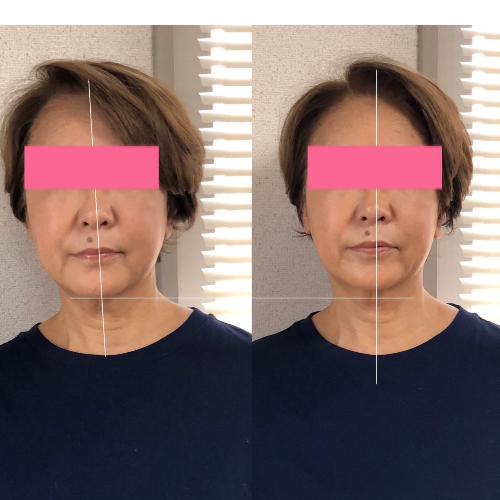 嶋崎明美さんのお客様のBeforeafter.jpeg