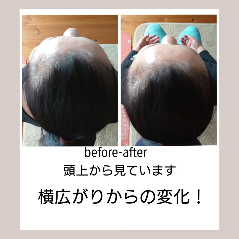 Beforeafter山口友香子さんのお客様.jpg