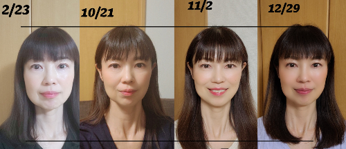 花麻衣さんのBeforeafter軌跡.png