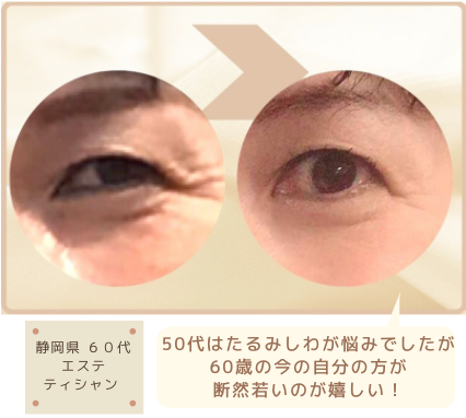 HPジェルBeforeafter.png