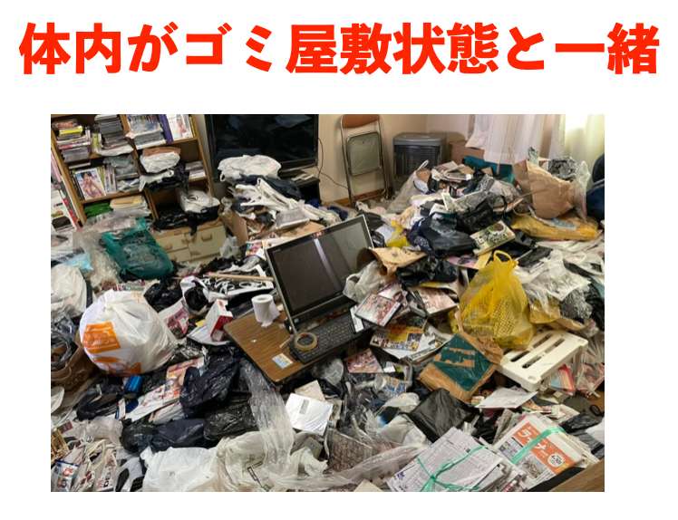 体内ゴミ屋敷１.png