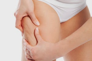 schema-cellulite-adipeuse.jpg