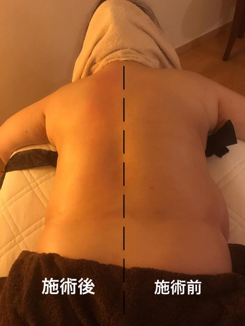 Oさん５６歳beforeafter.jpg