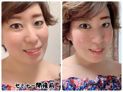 セルフ筋膜リリースbeforeafter.jpg