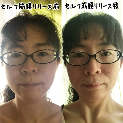 セルフ筋膜リリースbeforeafter岩田さん.jpg