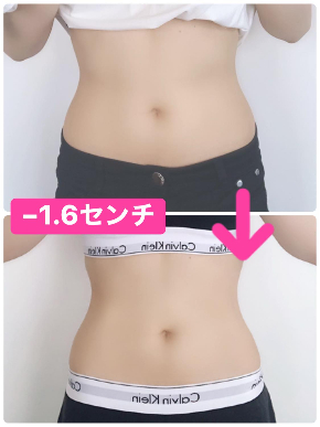 松本佳子さんbeforeafter.jpg