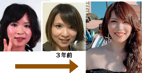 頭を小さくしたくてベルトを巻きつけて寝ていた吉村の小顔整形ストーリー2 小顔マジシャン