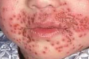 ｔ.png