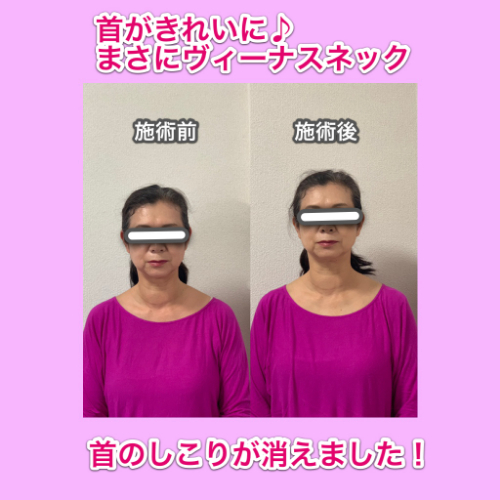 IMG_19DDED221A55-1.jpeg