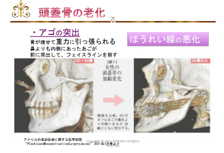 シンメトリ36.png