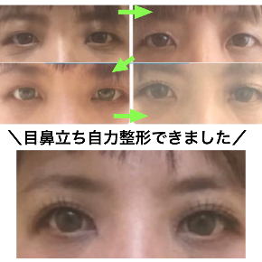 私がおばさんにな ってるぅ 15秒自力整形