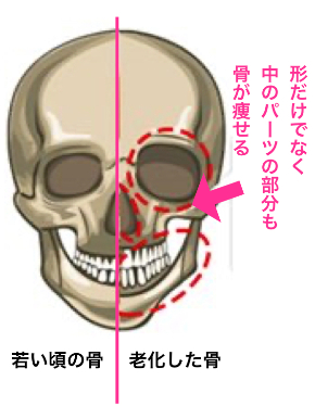 骨老化.002.jpeg