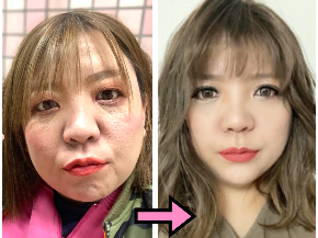自力整形メイクビフォーアフター.001.jpeg