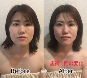 伊東さん1.jpg