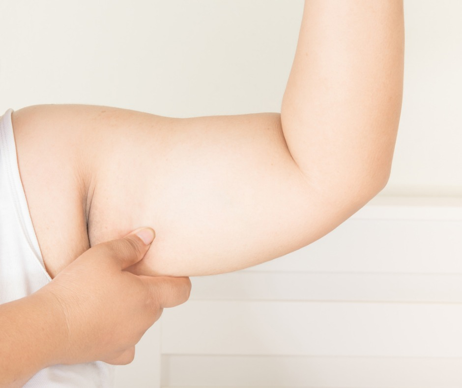 fat-arm-picture-id673819658.jpg