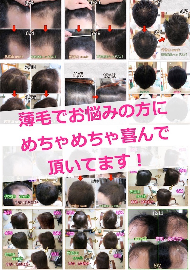 薄毛改善写真2020-03-13 1.32.19.jpg