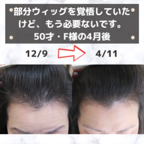 1.PNG