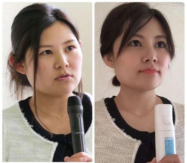 エリーナさんビフォーアフター.jpg