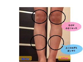 ひざビフォーアフター.002.jpeg