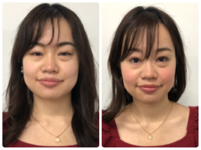 30才からの一重のお悩みを 自信と笑顔とキレイ に変える個別相談会