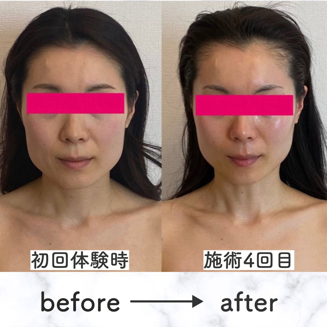 名称未設定のデザイン (2).png