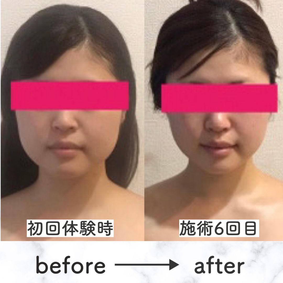 名称未設定のデザイン (4).png