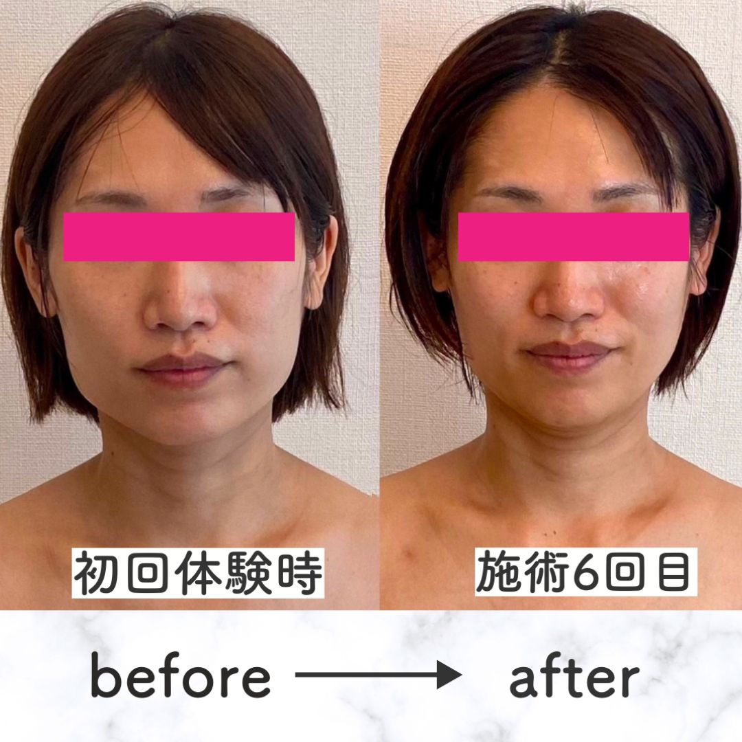 名称未設定のデザイン (3).png